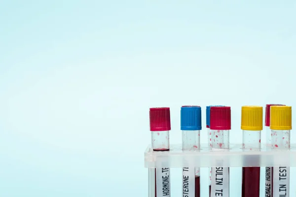 Test tubes with blood samples of hormones tests in stand isolated on blue — Stock Photo