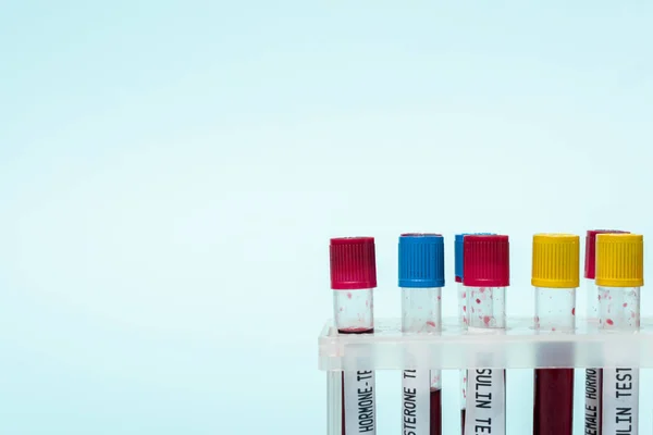 Test tubes with blood samples of hormones tests in stand isolated on blue — Stock Photo