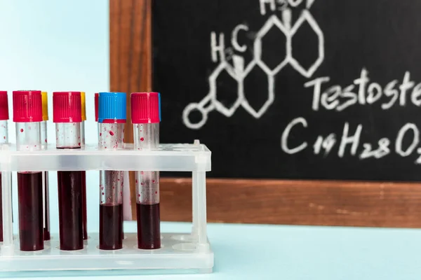 Foco seletivo de suporte com amostras de sangue em tubos de ensaio perto de quadro negro com fórmula de testosterona em fundo azul — Fotografia de Stock