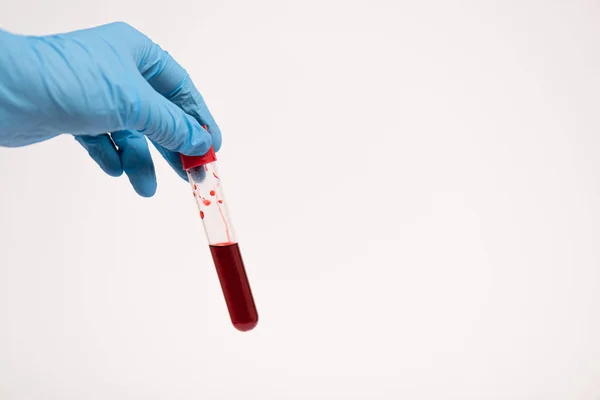 Vista recortada do médico em tubo de teste de retenção de luva de látex com amostra de sangue isolada em branco — Fotografia de Stock