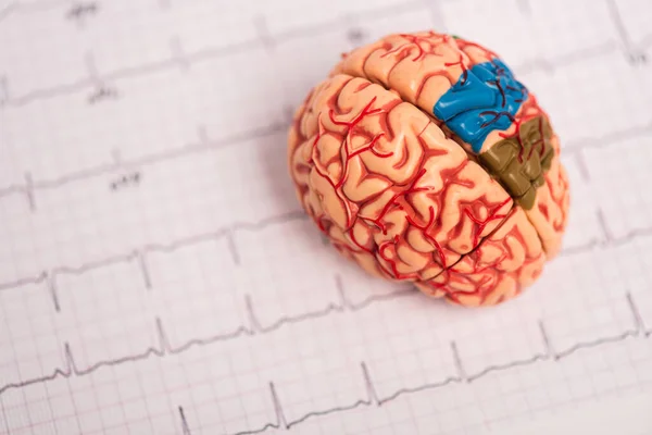 Enfoque selectivo del modelo cerebral con partes coloreadas en electrocardiograma aisladas en blanco - foto de stock