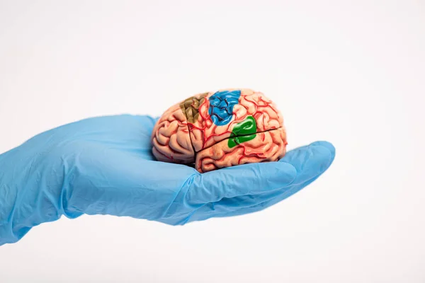 Обрезанный взгляд врача, держащего модель мозга с цветными частями, изолированными по белой концепции болезни Альцгеймера — стоковое фото