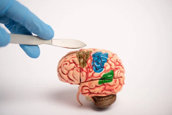 Cropped view of surgeon holding scalpel near brain model on white background, alzheimer disease concept — Stock Photo