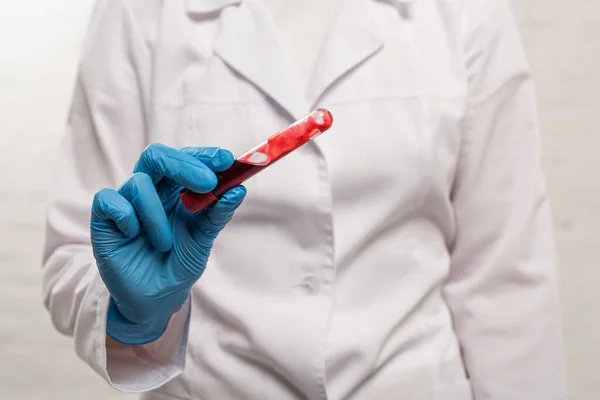 Foco seletivo do médico segurando tubo de teste com amostra de sangue no fundo branco — Fotografia de Stock