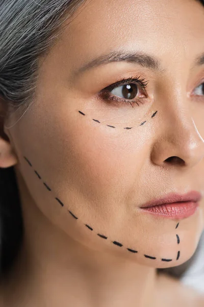 Schöne asiatische Frau mit plastischen Chirurgie Korrekturzeichen auf dem Gesicht isoliert auf grau — Stockfoto