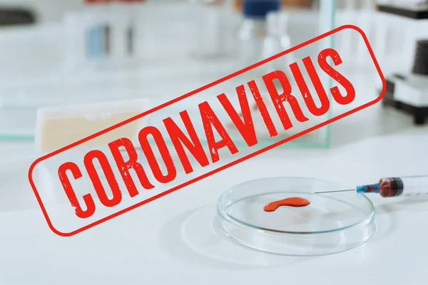 Selektiver Fokus von Spritze und Petrischale mit Blutprobe in der Nähe weißer Maus im Glaskasten, Coronavirus-Illustration — Stockfoto