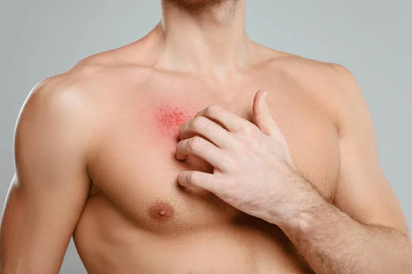 Teilansicht eines Mannes, der die Haut mit einer Allergie kratzt, isoliert auf grau — Stockfoto