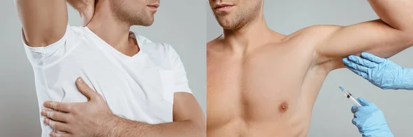 Collage of man with sweaty armpit and doctor doing botox injection from hyperhidrosis on grey, panoramic shot — Stock Photo