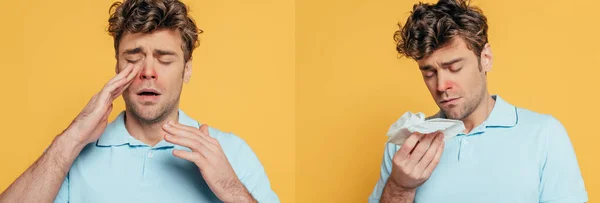 Collage of man suffering from sickness with napkins on yellow, panoramic shot — Stock Photo