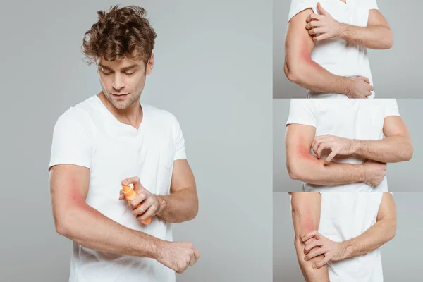 Collage eines Mannes, der Sonnencreme aufträgt und die Hand mit Allergie auf Grau kratzt — Stockfoto