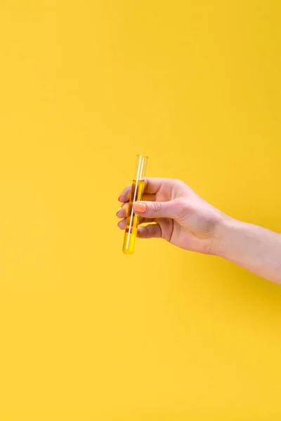 Abgeschnittene Aufnahme einer Frau mit einer Flüssigkeitsflasche, isoliert auf gelb — Stockfoto