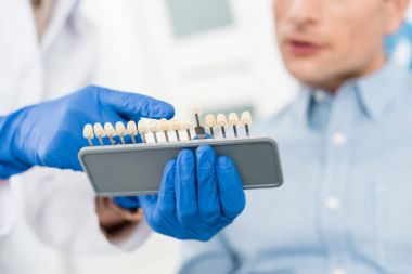 Diş implantları için modern diş Kliniği erkek hastada gösteren doktor