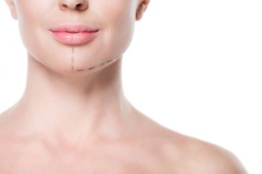Yüz plastik cerrahi üzerine beyaz izole için boyalı çizgilerle kadının kırpılmış görünümü