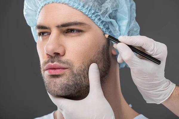 Doctor drawing lines for facelifting on man, isolated on grey — Stock Photo