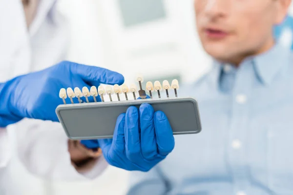 Doctor showing tooth implants to male patient in modern dental clinic — Stock Photo