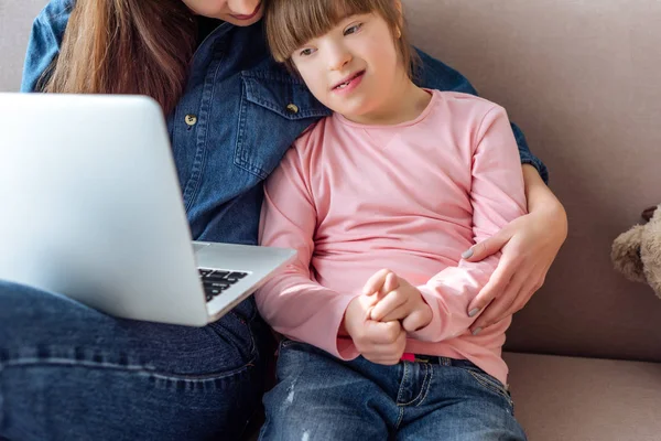 Mother and daughter with down syndrome using laptop — Stock Photo