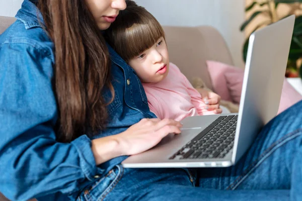 Madre e hija con síndrome de Down mirando a la pantalla del ordenador portátil - foto de stock