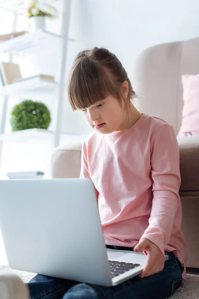 Kid with down syndrome using laptop — Stock Photo
