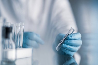 Kovid-19 veya koronavirüs etiketli plastik tüp tutan bilim adamı, salgın için laboratuvar testleri