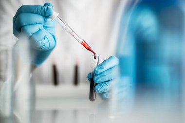 Kan testi tüpü tutan bilim adamı, ilaç için laboratuvar testi.