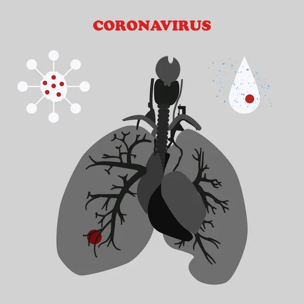 Longen van de patiënt, virusstempels - druppelspray - geïsoleerd op een lichte achtergrond - vector. Ontwerpelement. Coronavirus. Pandemisch concept. — Stockvector