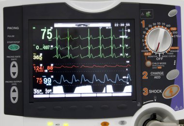 Hastanedeki Ekg monitörünün detayları.