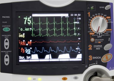 Hastanedeki Ekg monitörünün detayları.