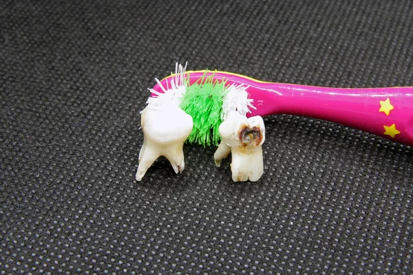 坏牙齿和牙刷 牙齿卫生 腐烂的牙齿和牙刷 — 图库照片