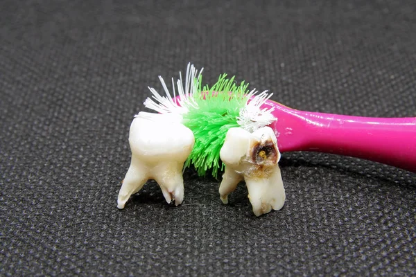 Bad tooth and toothbrush. Dental hygiene.Rotten tooth and toothbrush. Extracted tooth.
