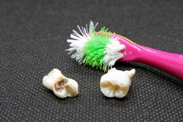 Slechte Tand Tandenborstel Tandhygiëne Rotte Tand Tandenborstel Uitgetrokken Tand — Stockfoto