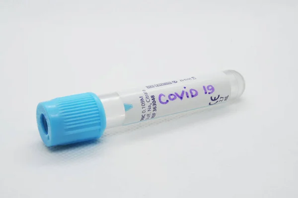 Tubo Prova Virus Test Del Virus Test Infezione Virale — Foto Stock