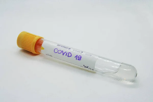 Virus Test Tube Testing Virus Viral Infection Test — Stock Photo, Image