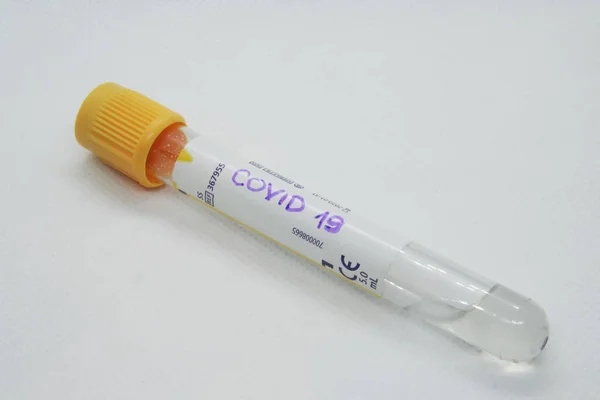 Tubo Ensayo Del Virus Probando Virus Prueba Infección Viral — Foto de Stock