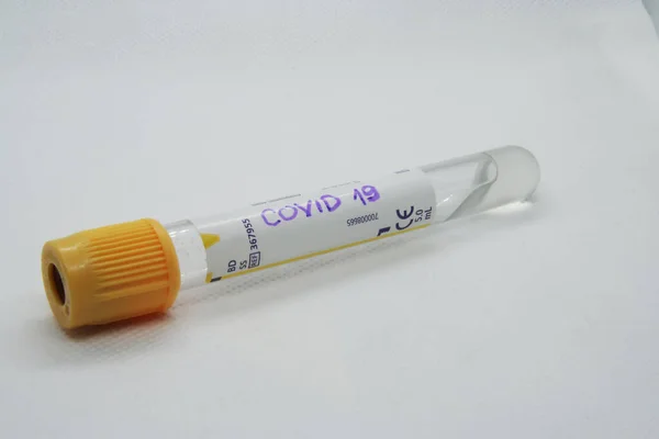 Virus test tube. Testing virus. Viral infection test.