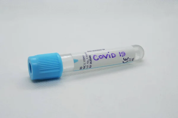 Tubo Teste Vírus Testar Vírus Teste Infecção Viral — Fotografia de Stock