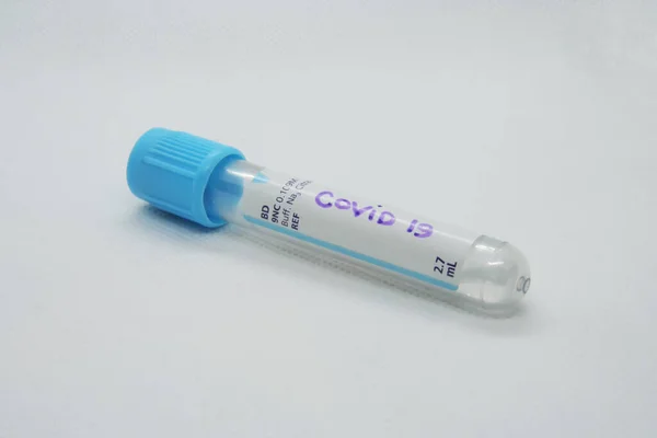 Vírus Kémcső Vírus Teszt Vírusfertőzés Vizsgálat Stock Kép