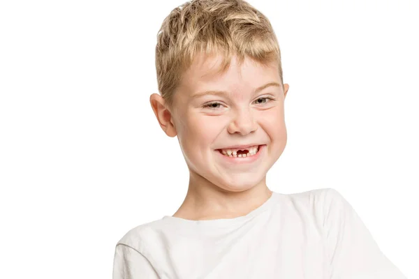 Schattige Kleine Jongen Zonder Voorste Tanden Lachen Geïsoleerd Witte Achtergrond — Stockfoto