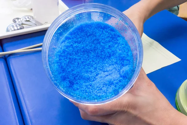Mãos segurando copo de produto químico azul, sulfato de cobre Pentahydr — Fotografia de Stock