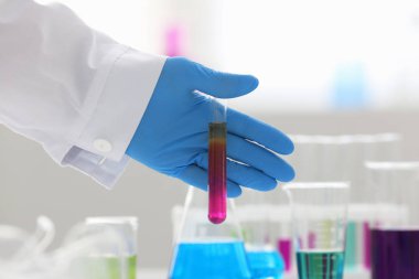 Bir erkek kimyager tüp elinde bardak sıvı bir çözüm taşmaları tutar