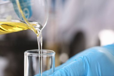 Tüp Bebek koruyucu eldiven erkek el ele tutuşur