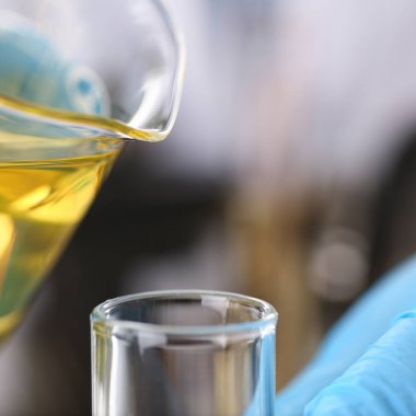 Tüp Bebek koruyucu eldiven erkek el ele tutuşur