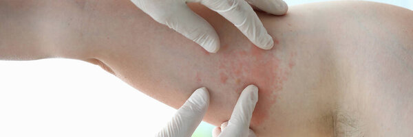 Male doctor in white protective gloves examing patient
