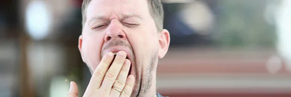 Exhausted Sleepy Male Yawning Facial Portrait — Stock Photo, Image