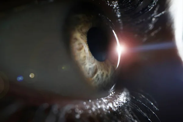 Женский глаз при осмотре хирургической клиники крупным планом — стоковое фото