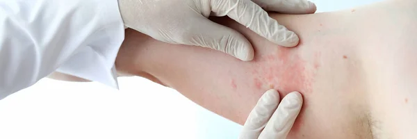 Médico masculino em luvas de proteção brancas examinando paciente — Fotografia de Stock