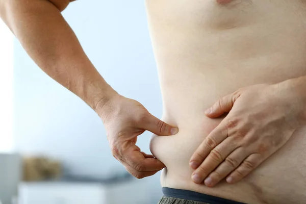 Ragazzo con un eccesso di grasso — Foto Stock