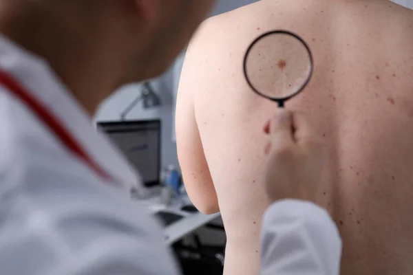 Αρσενικός γιατρός εξετάσει μεγεθυντικό φακό στο δέρμα του ασθενούς — Φωτογραφία Αρχείου