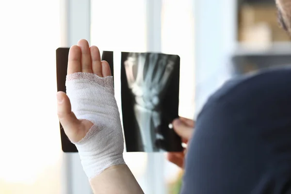 Erkek bandajlı eller x-ray görüntüsünü yakın tutuyor — Stok fotoğraf