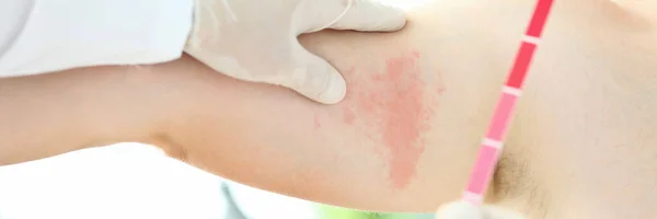 Smart dermatolog läkare — Stockfoto