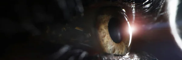 Kobieta oko na zbliżenia kliniki chirurgicznej — Zdjęcie stockowe